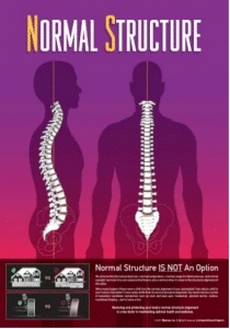 Chiropractic Nepean ON Normal Structure